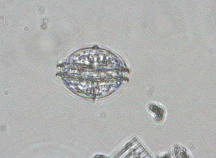 Dictyocha speculum